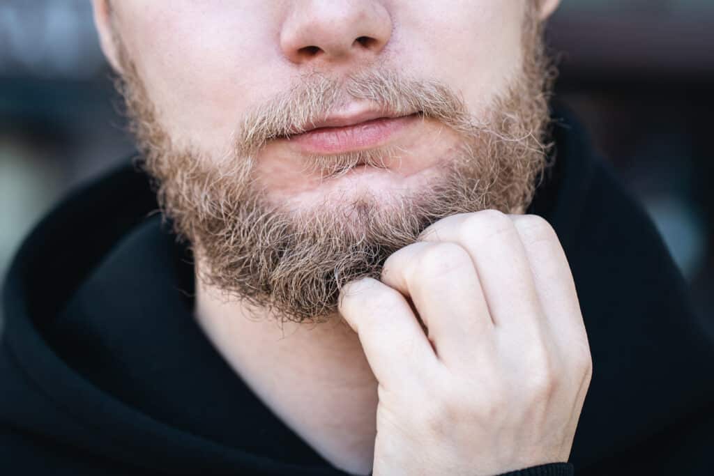 Pellicules de barbe